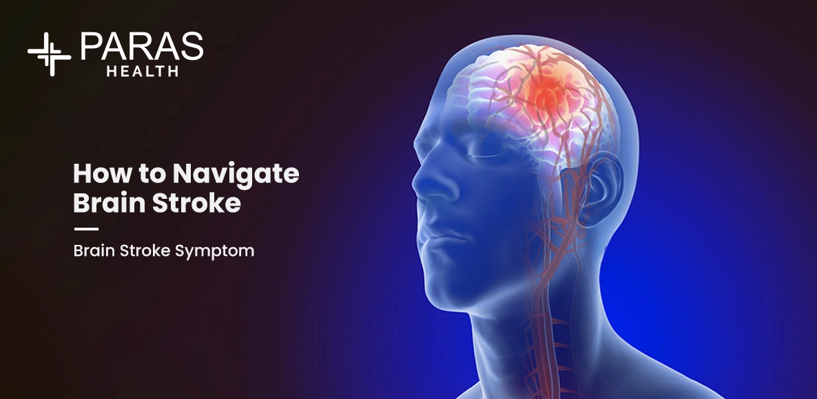 How to Navigate Brain Stroke – Brain Stroke Symptoms, Brain Stroke Management